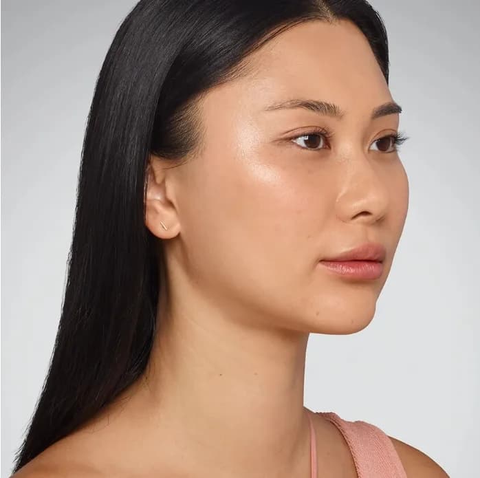 Woman with lifted cheeks and glowing skin after Juvederm treatment, from the treatment gallery on the practice's previous website