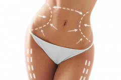 Body Contouring