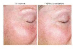 gentlewaves2-500x412