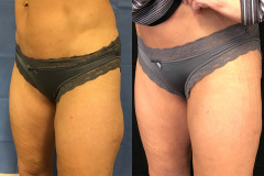legs-1