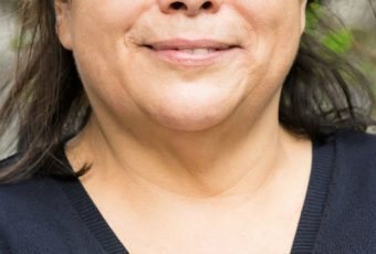 My face and neck are aging. I need help.