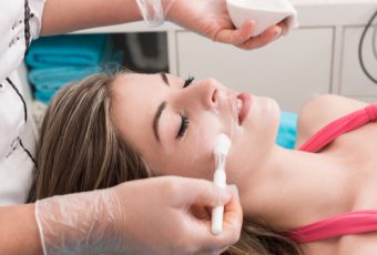 Look Your Best with Chemical Peels