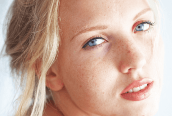 How Long Does a Thermage Treatment Last?