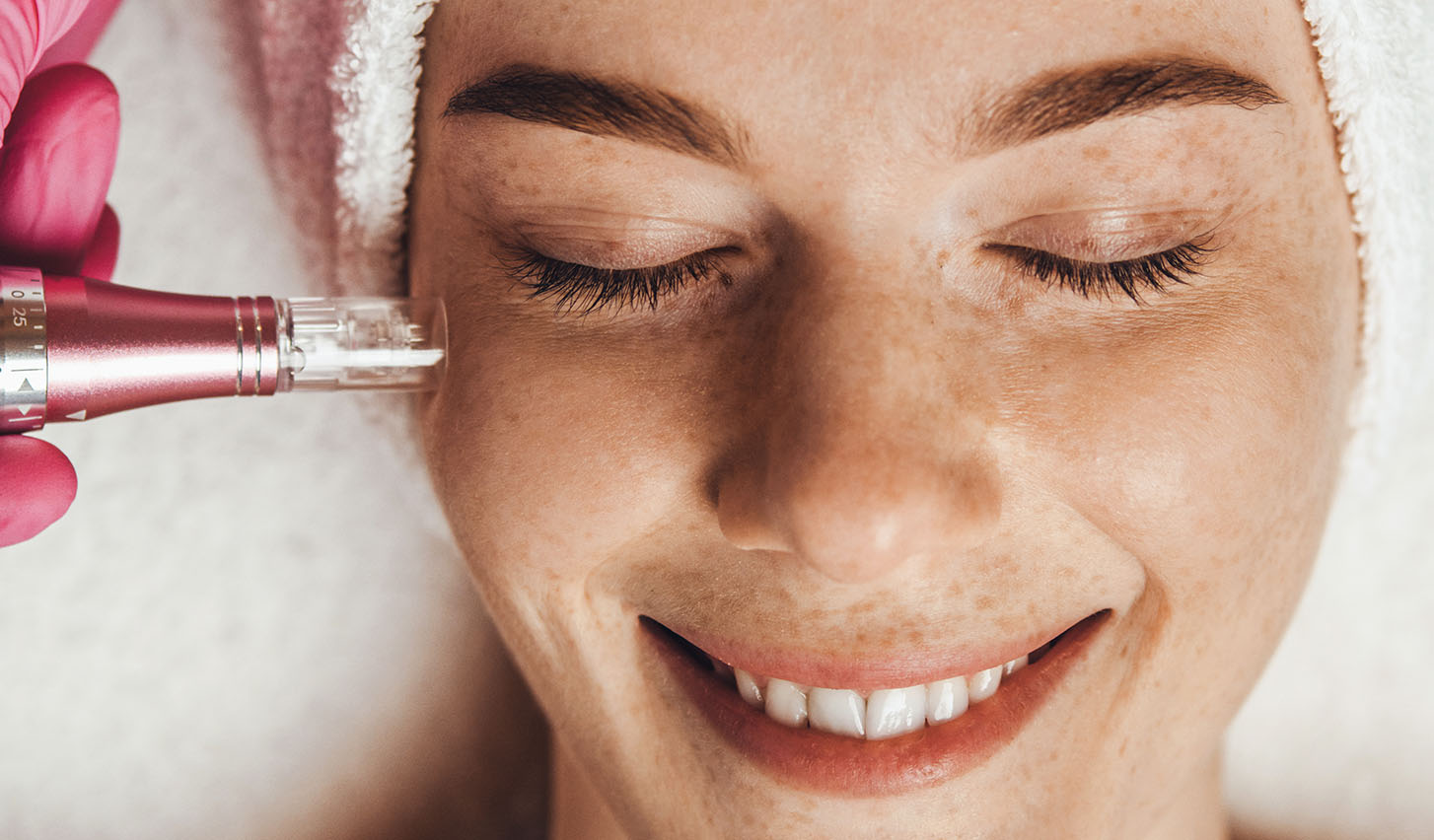 How Often Can You Get Microdermabrasion?