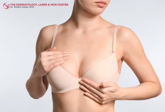 The Benefits of Vaser Liposuction for Breast Reduction