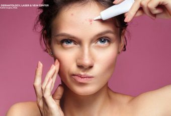 Benefits of Laser Acne Treatment in Cincinnati, Ohio
