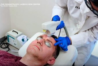 Benefits of BBL Skin Resurfacing Treatments in Cincinnati, Ohio