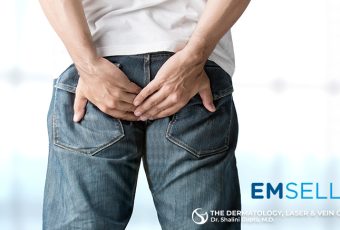 Fecal Incontinence Treatment | EMSELLA Cincinnati, Ohio