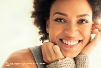 How Long Does Microneedling Last?