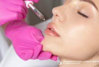 How Much Do Lip Fillers Cost in Cincinnati, Ohio?