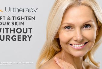 Face Lift Without Surgery in Cincinnati, Ohio | Non-Surgical Ultherapy