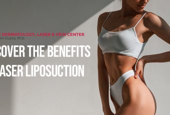 Discover the Benefits of Vaser Liposuction in Cincinnati, Ohio