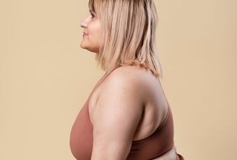 Vaser Liposuction for Buffalo Hump Removal in Cincinnati, Ohio