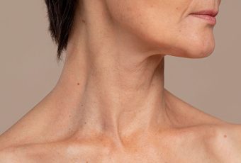 Best Drooping Jowls and Sagging Neck Treatment in Cincinnati, Ohio