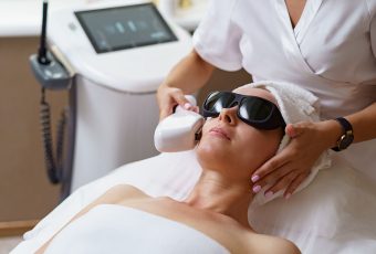 How Long Does Laser Skin Resurfacing Last?