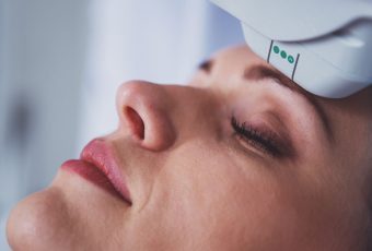 What Is the Best Age for Laser Resurfacing?