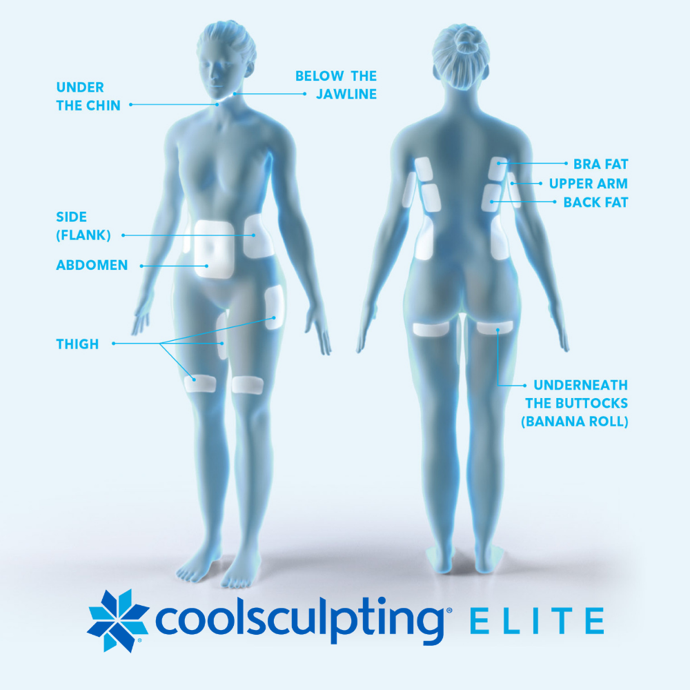 coolsculpting-treatment-areas