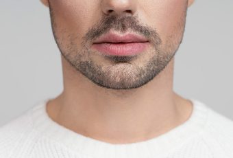 Jawline Filler for Men: Boosting Confidence with a Stronger Jawline