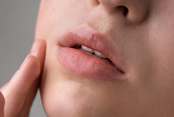 Lip Filler Trends: Plump and Natural Looks for 2025