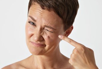 Crow’s Feet Treatment in Cincinnati: Smooth Away Fine Lines with Injectables