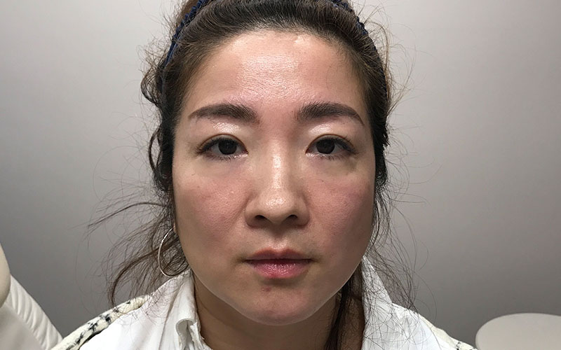 b3.jpg Face Treatments Cincinnati