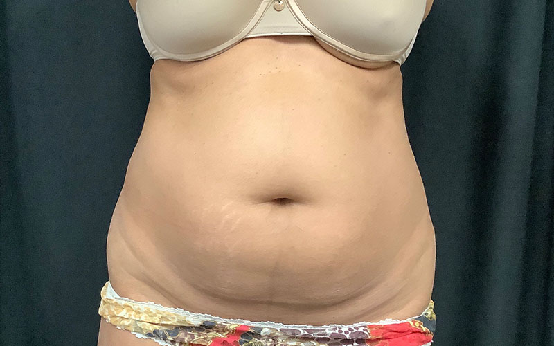 b5-1.jpg Body Treatments Cincinnati