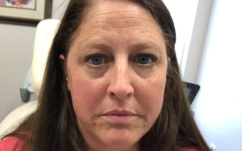 b7.jpg Cosmetic Dermatology Cincinnati