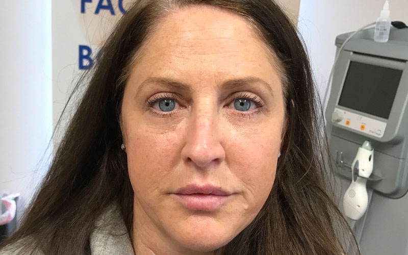 Cosmetic Dermatology