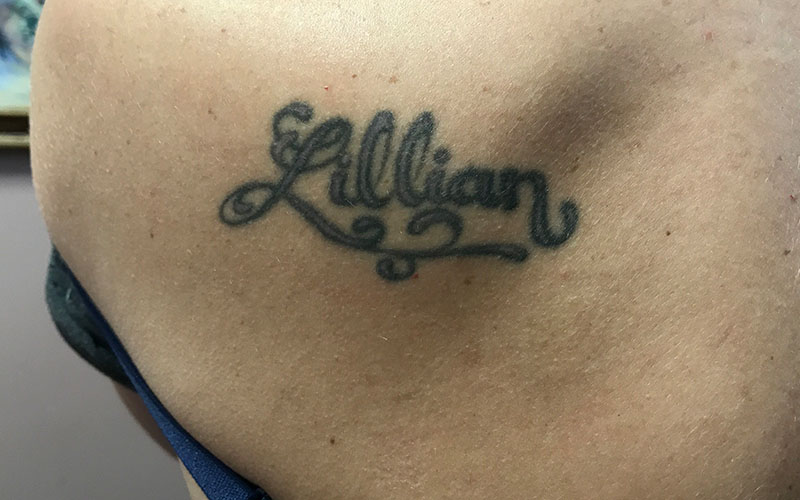 ba13.jpg Body contouring Cincinnati