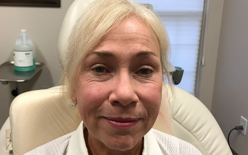 ba19.jpg Cosmetic Dermatology