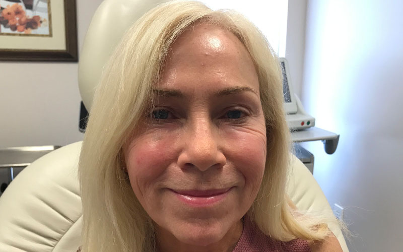 Cosmetic Dermatology in Cincinnati