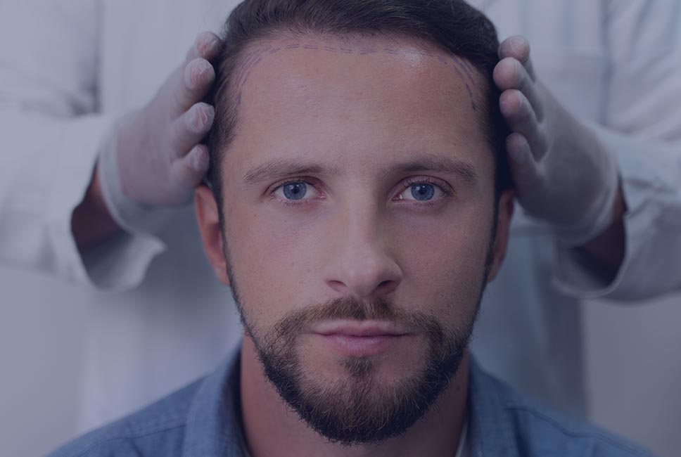 hair-restoration-featured.jpg
