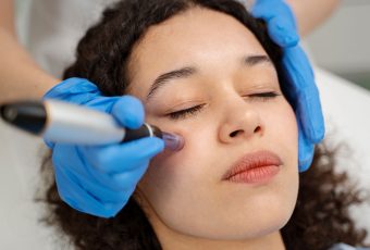 Microneedling Treatments Near Me – Cincinnati, Ohio