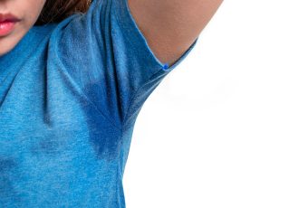 Botox for Sweating Treatment in Cincinnati, Ohio