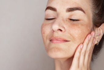 Best Treatment for Age Spots