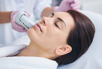 Best Treatment for Sun Damage: How BBL Laser Can Rejuvenate Your Skin