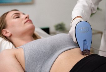 How Does Morpheus8 Help with Skin Tightening?