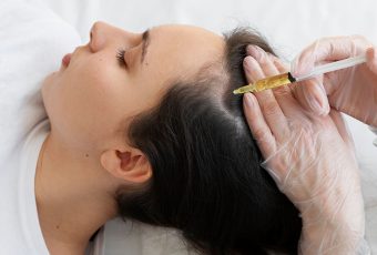 How to Treat Hair Loss with Plasma Protein Therapy