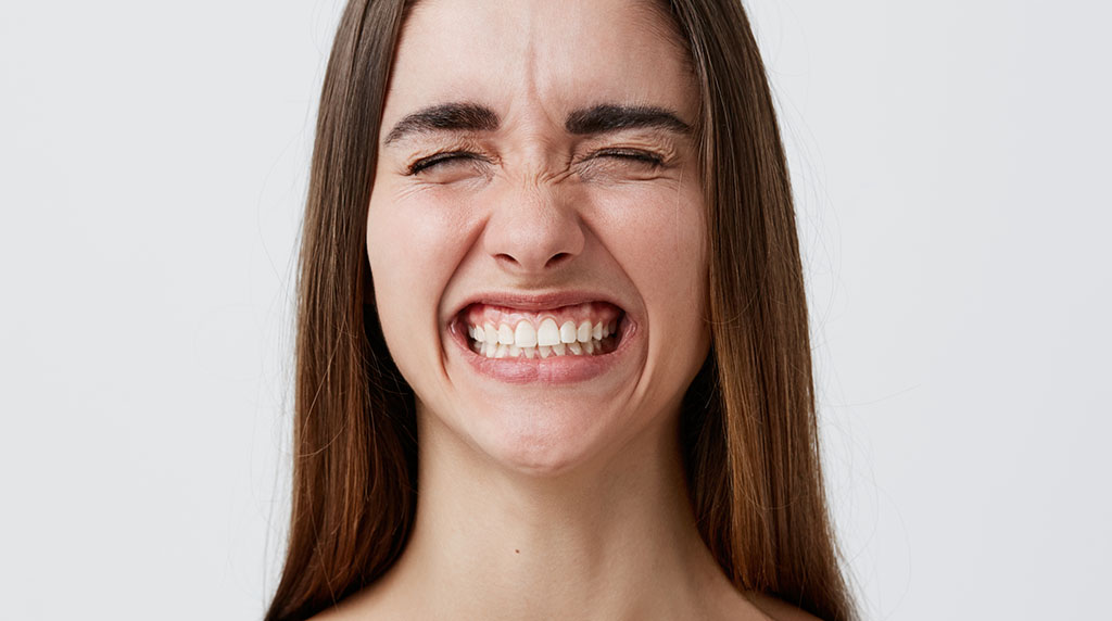 Gummy Smile Treatment Botox Cincinnati Ohio