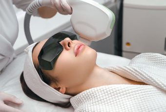 Is IPL Laser Treatment Worth It?