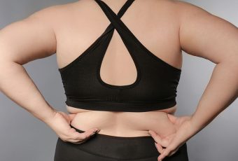 Permanent Bra Fat Reduction with VASER Lipo