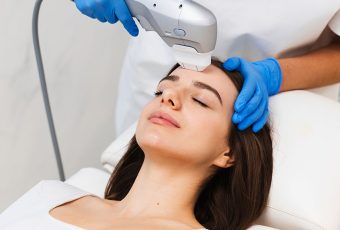 What Does IPL Laser Treat?