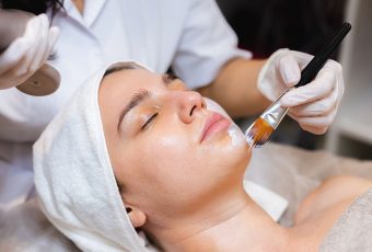 Best Chemical Peels in Cincinnati: Where to Get Glowing, Renewed Skin