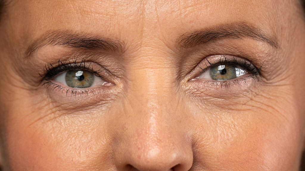 EMFACE Eyes for Hooded Eyelids Can It Really Lift the Brow cincinnati
