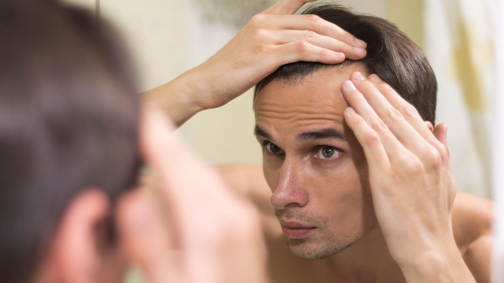 Hairline Lowering with SmartGraft What to Expect from a Precision Hair Transplant cincinnati