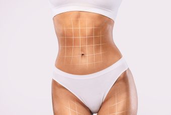 Liposuction vs. Tummy Tuck: Which One Is Right for You?