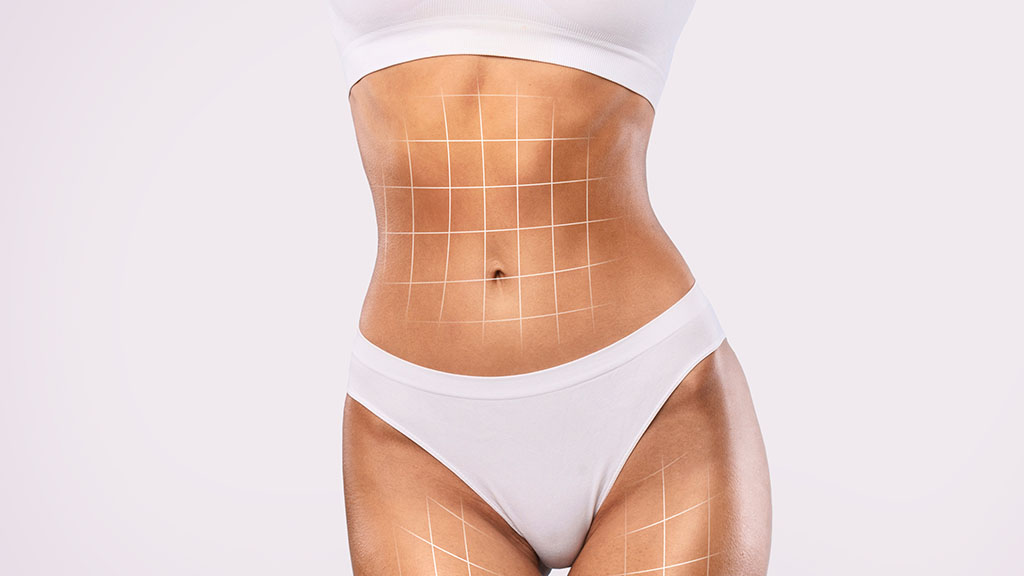 Liposuction vs. Tummy Tuck Which One Is Right for You cincinnati