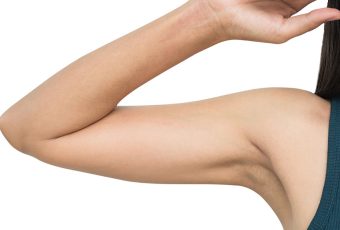 Sculpt Your Arms with Liposuction: Say Goodbye to Stubborn Fat