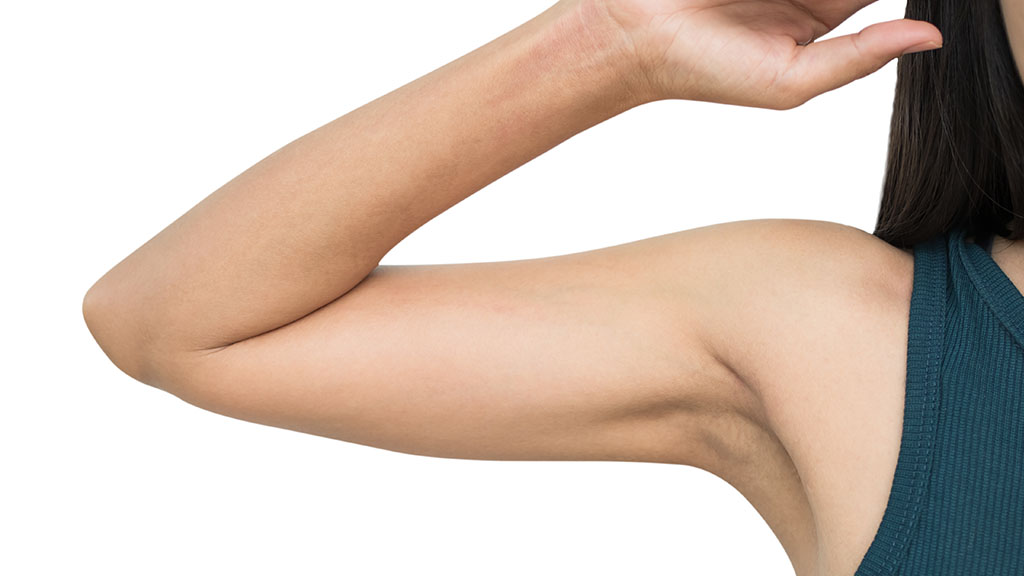Sculpt Your Arms with Liposuction Say Goodbye to Stubborn Fat cincinnati
