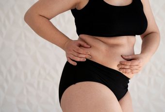 Sculpt Your Flanks with Liposuction: Targeting Love Handles Effectively